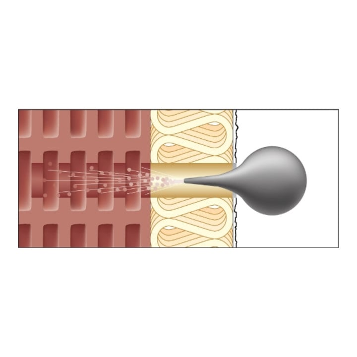 CELO ResiTHERM 160 2 st., incl. 1x ResiFIX VY300SF, Niro A4 set