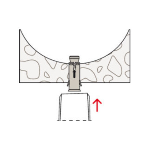 fischer Cheville à expansion pour plafond creux FHY M10