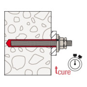 fischer Verfüllset M24 R-5