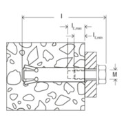 fischer Zykon-Innengewindeanker FZA 12x40 M6 I-4